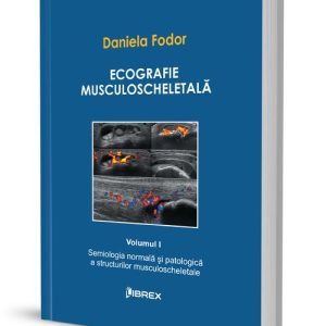 Ecografie musculoscheletală - Daniela Fodor - Vol. I