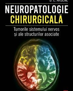 Neuropatologie chirurgicala. Tumorile sistemului nervos - Dr. Dorel Eugen Arsene
